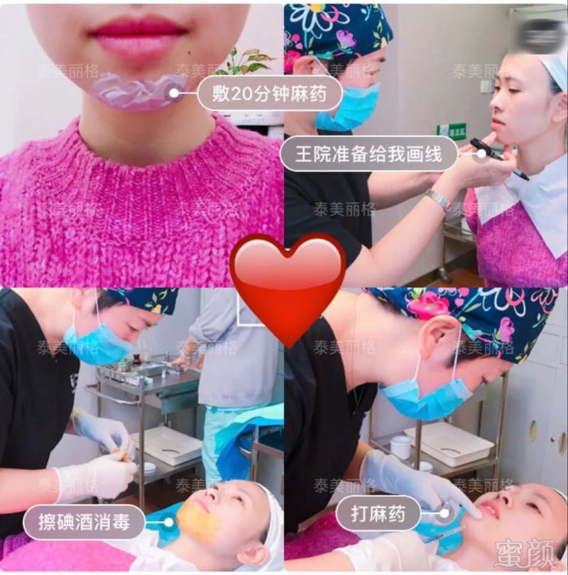 https://img.miyanlife.com/mnt/timg/190124/123J15a4-2.jpg