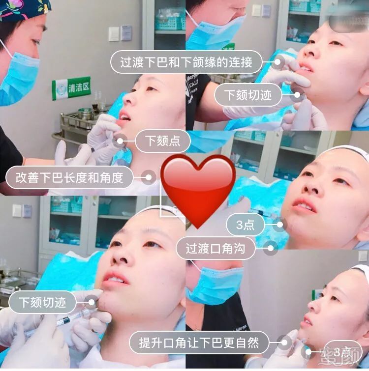 https://img.miyanlife.com/mnt/timg/190124/123K360c-3.jpg