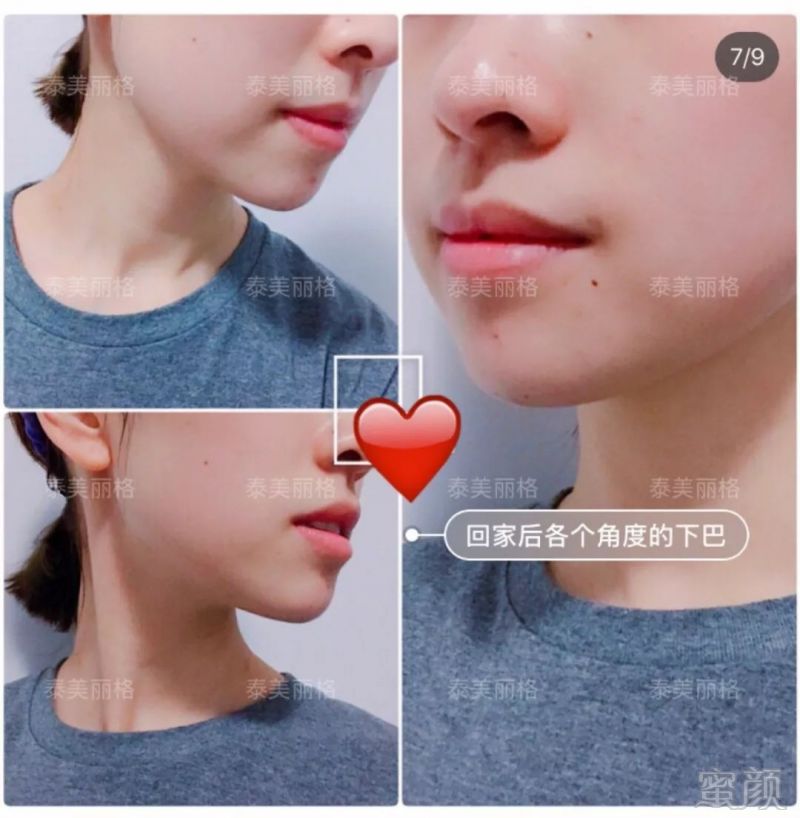 https://img.miyanlife.com/mnt/timg/190124/123Q51112-5.jpg