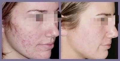 https://img.miyanlife.com/mnt/timg/190124/12405R201-9.jpg