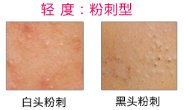 https://img.miyanlife.com/mnt/timg/190124/12405Sb1-5.jpg