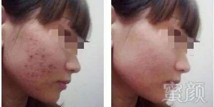 https://img.miyanlife.com/mnt/timg/190124/12405T446-10.jpg