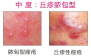 https://img.miyanlife.com/mnt/timg/190124/12405U2B-6.jpg