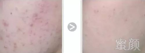 https://img.miyanlife.com/mnt/timg/190124/12405WL8-12.jpg