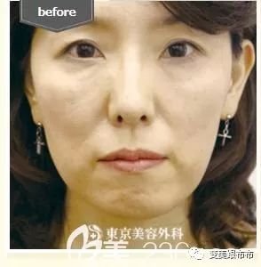 https://img.miyanlife.com/mnt/timg/190124/124444G54-0.jpg