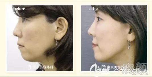 https://img.miyanlife.com/mnt/timg/190124/1244453951-2.jpg