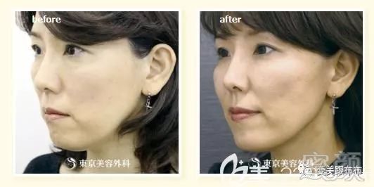 https://img.miyanlife.com/mnt/timg/190124/1244455P7-3.jpg