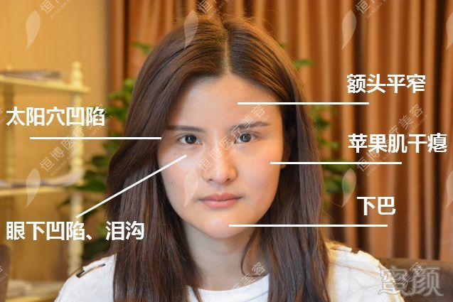 https://img.miyanlife.com/mnt/timg/190124/125Q1D34-4.jpg
