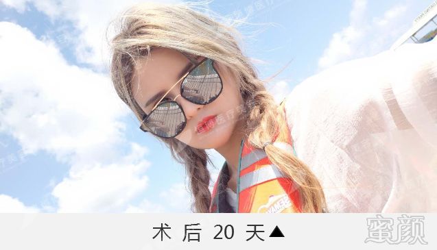 https://img.miyanlife.com/mnt/timg/190124/125Q241c-10.jpg