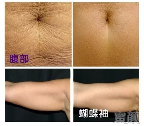 https://img.miyanlife.com/mnt/timg/190125/111A2N26-9.jpg