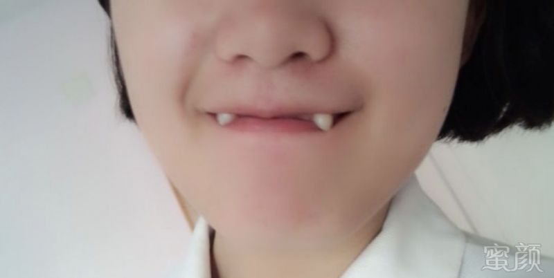 https://img.miyanlife.com/mnt/timg/190125/121I61062-1.jpg