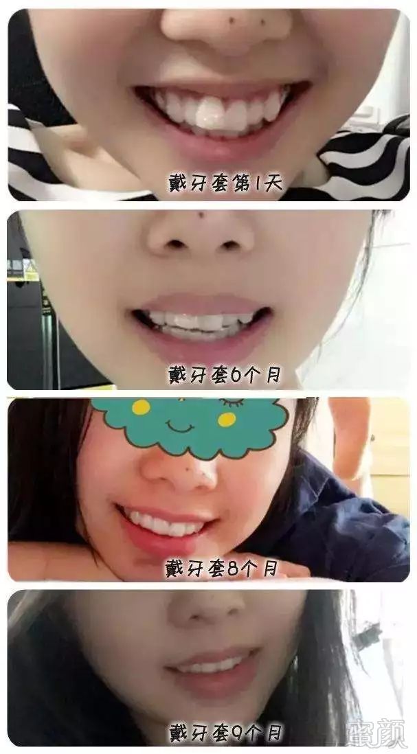 https://img.miyanlife.com/mnt/timg/190125/121I62532-4.jpg