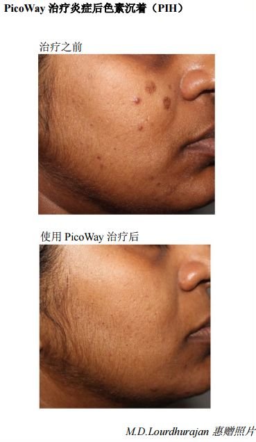 https://img.miyanlife.com/mnt/timg/190125/13011J347-2.jpg