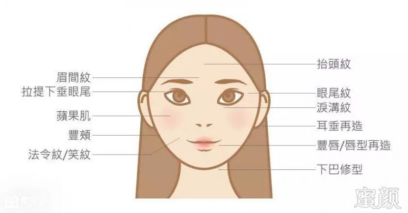 https://img.miyanlife.com/mnt/timg/190125/13043SH3-1.jpg