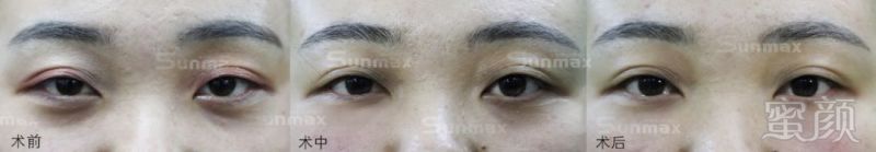 https://img.miyanlife.com/mnt/timg/190125/13063225J-8.jpg