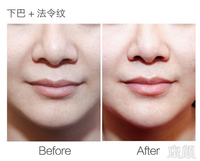 https://img.miyanlife.com/mnt/timg/190125/1306323U6-5.jpg