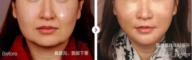 https://img.miyanlife.com/mnt/timg/190125/1330546027-7.jpg