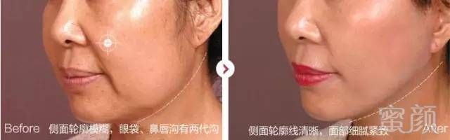 https://img.miyanlife.com/mnt/timg/190125/133054O28-6.jpg