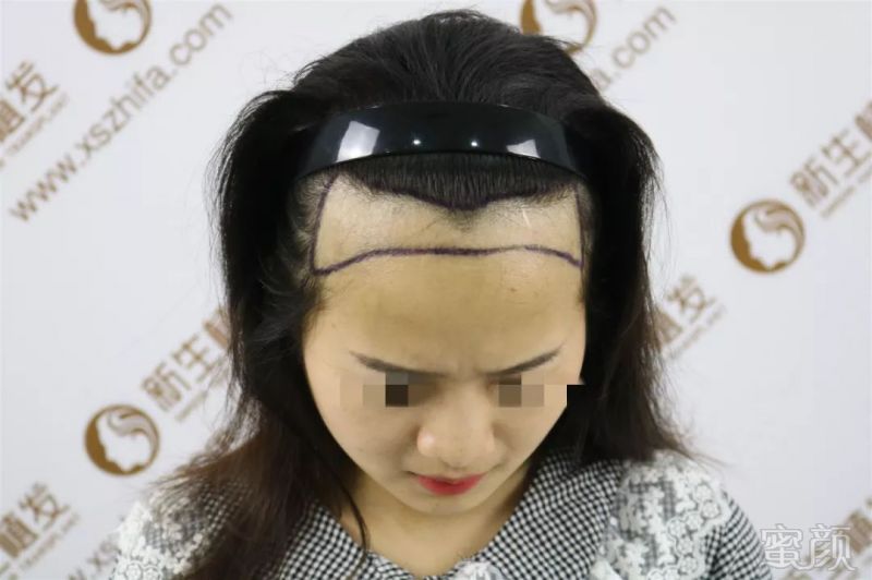 https://img.miyanlife.com/mnt/timg/190125/133941GG-2.jpg