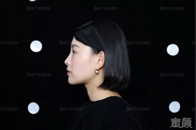https://img.miyanlife.com/mnt/timg/190125/133Q04341-3.jpg