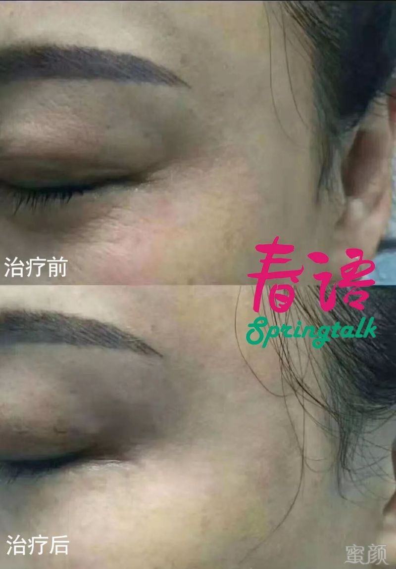 https://img.miyanlife.com/mnt/timg/190126/104J2L26-4.jpg