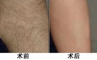 https://img.miyanlife.com/mnt/timg/190126/11423461L-0.jpg