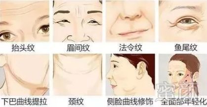 https://img.miyanlife.com/mnt/timg/190126/1210051130-0.jpg