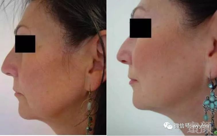 https://img.miyanlife.com/mnt/timg/190126/1210064J1-5.jpg
