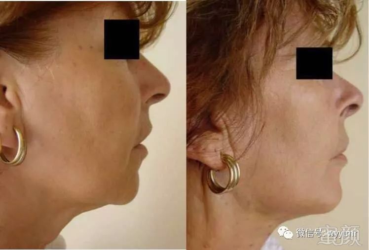 https://img.miyanlife.com/mnt/timg/190126/12100CS0-6.jpg