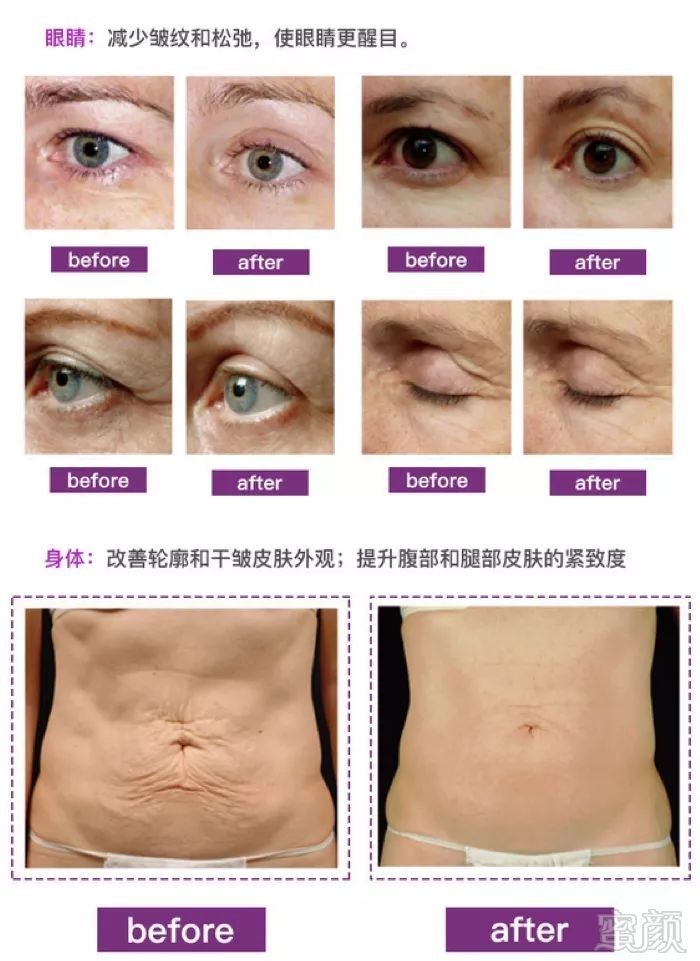 https://img.miyanlife.com/mnt/timg/190126/12221131R-12.jpg