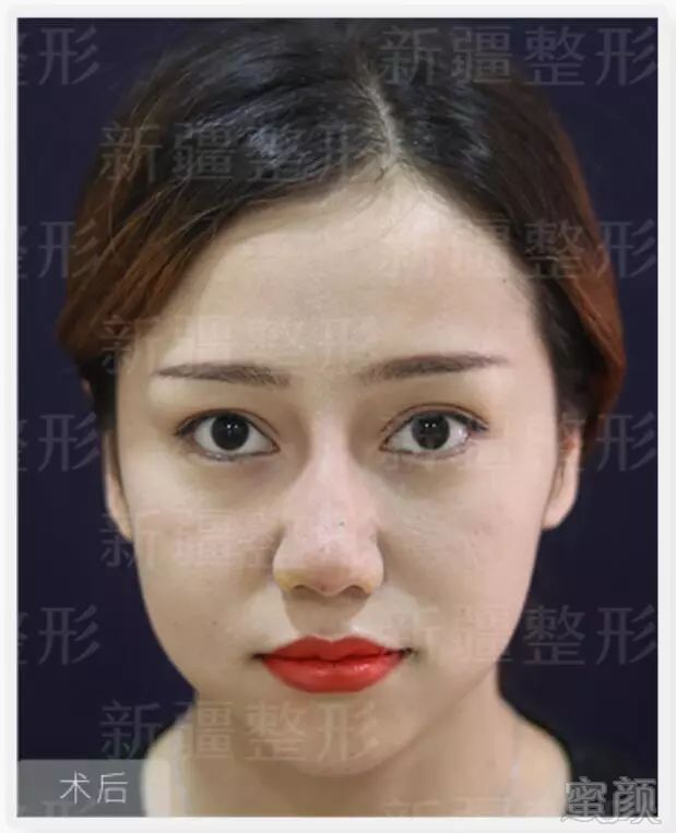 https://img.miyanlife.com/mnt/timg/190126/1241264130-5.jpg