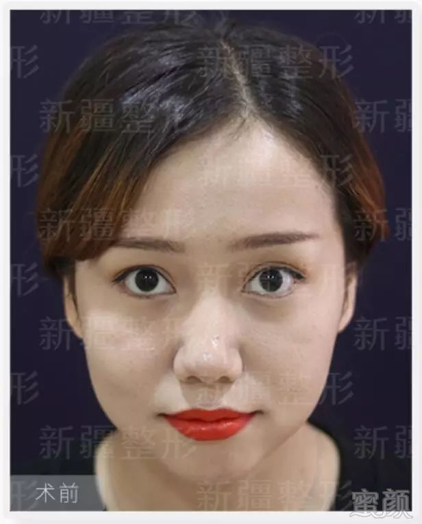 https://img.miyanlife.com/mnt/timg/190126/1241264F0-3.jpg