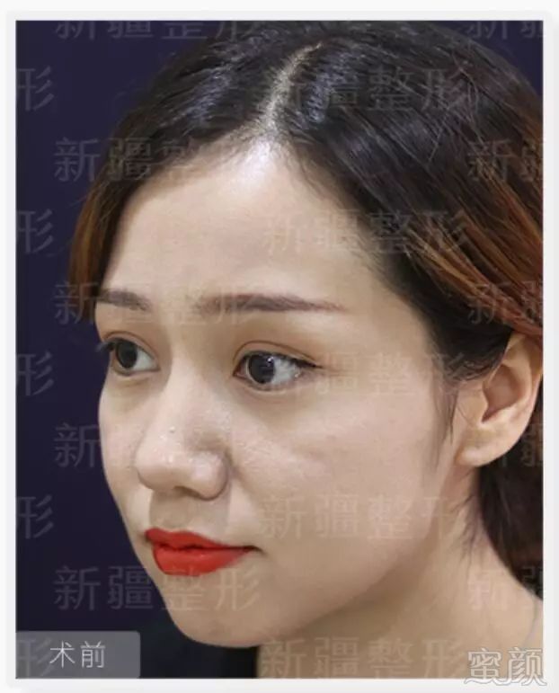 https://img.miyanlife.com/mnt/timg/190126/1241264K6-2.jpg