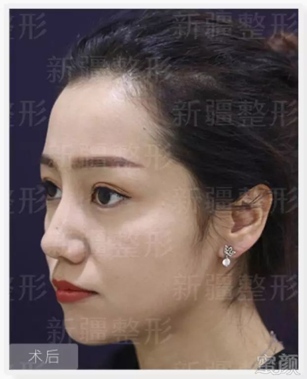 https://img.miyanlife.com/mnt/timg/190126/12412C5A-4.jpg