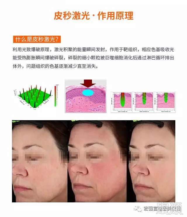 https://img.miyanlife.com/mnt/timg/190127/1202421H6-3.jpg