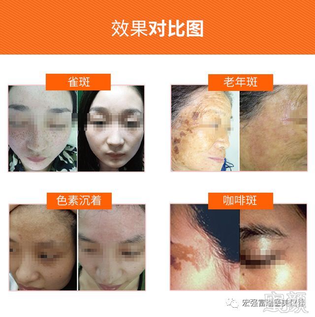 https://img.miyanlife.com/mnt/timg/190127/120243L45-7.jpg