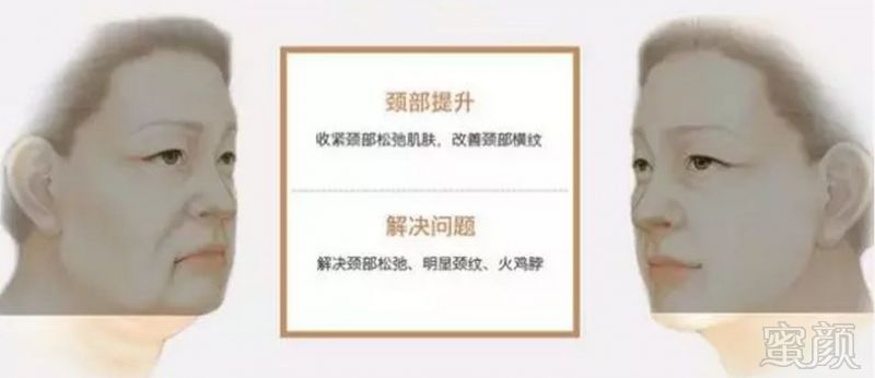 https://img.miyanlife.com/mnt/timg/190127/1210031G9-5.jpg