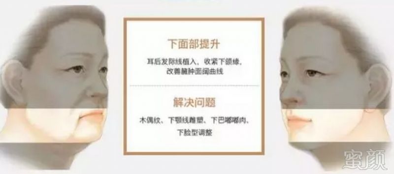 https://img.miyanlife.com/mnt/timg/190127/1210032057-4.jpg