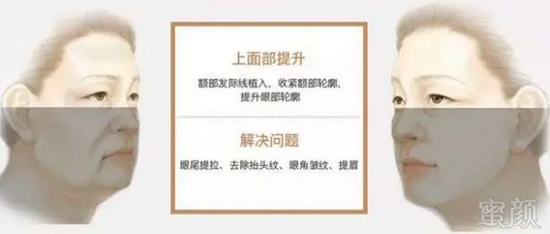 https://img.miyanlife.com/mnt/timg/190127/1210032914-2.jpg