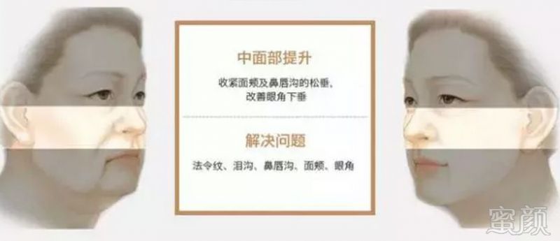 https://img.miyanlife.com/mnt/timg/190127/1210034364-3.jpg