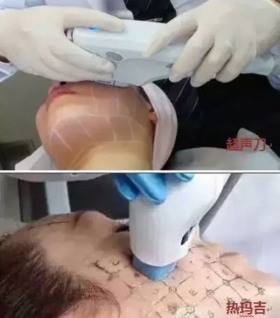 https://img.miyanlife.com/mnt/timg/190127/1231522F2-1.jpg