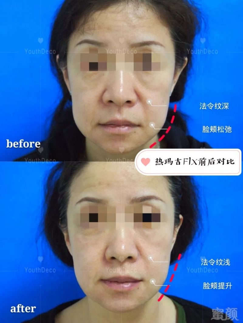 https://img.miyanlife.com/mnt/timg/190127/12501M241-0.jpg