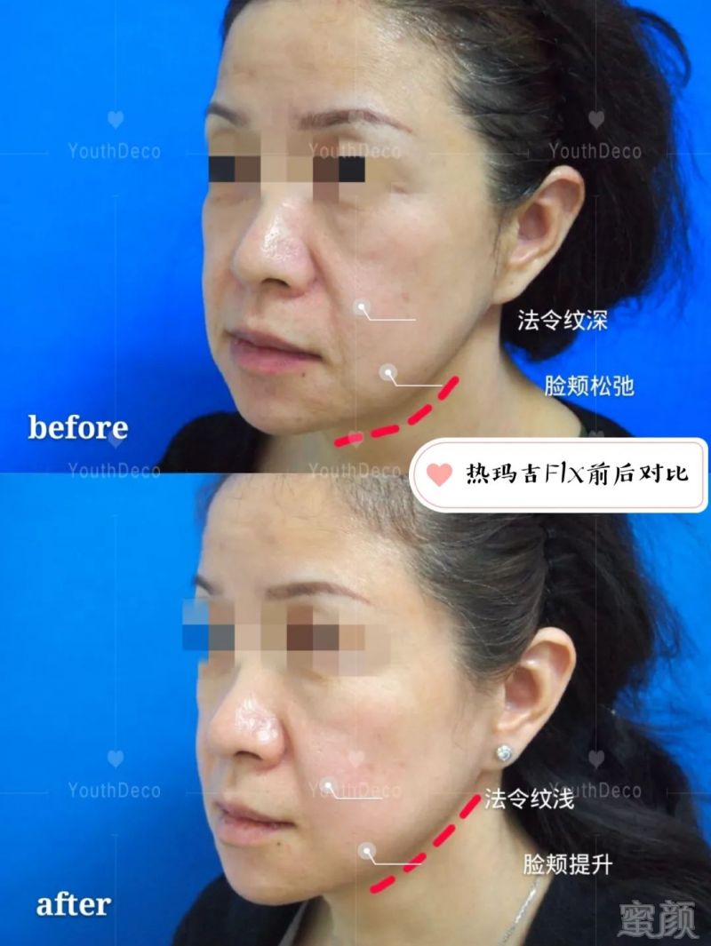 https://img.miyanlife.com/mnt/timg/190127/12501SW5-1.jpg