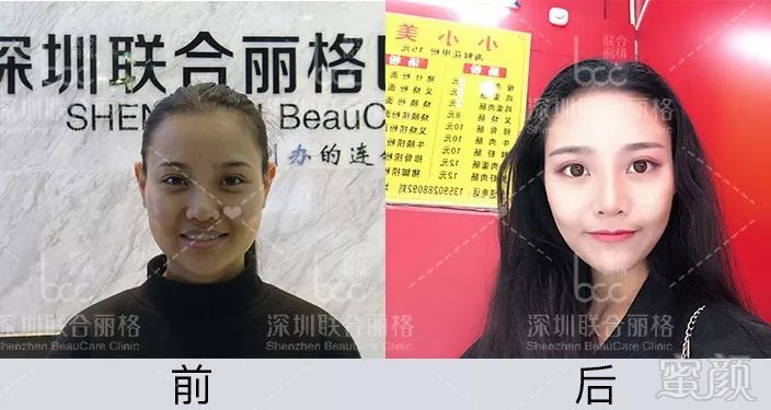 https://img.miyanlife.com/mnt/timg/190128/1101591058-2.jpg