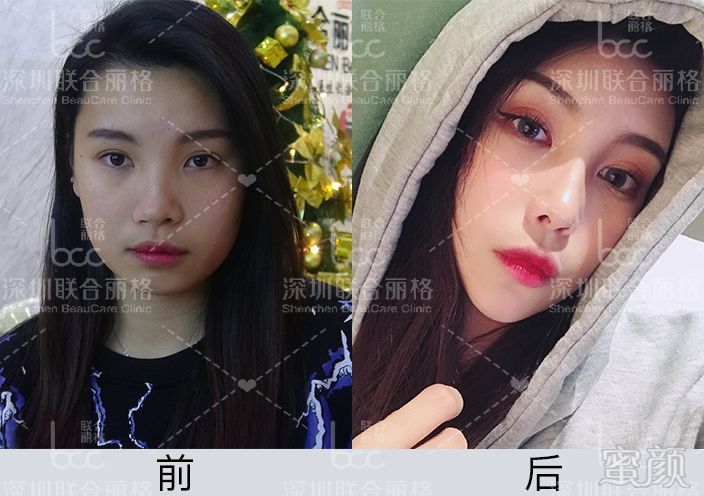 https://img.miyanlife.com/mnt/timg/190128/1101596431-3.jpg