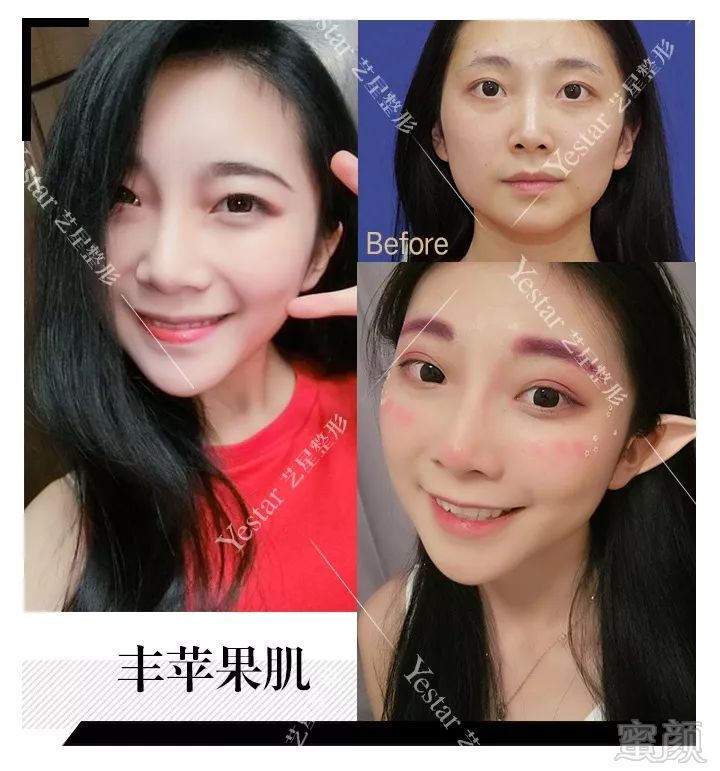 https://img.miyanlife.com/mnt/timg/190128/11025M343-5.jpg