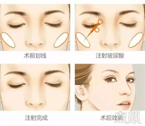 https://img.miyanlife.com/mnt/timg/190128/11025S258-7.jpg