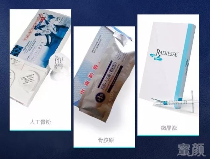 https://img.miyanlife.com/mnt/timg/190128/112K42514-0.jpg