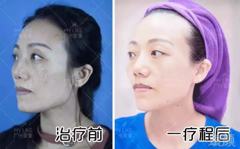 https://img.miyanlife.com/mnt/timg/190128/11443W1G-1.jpg
