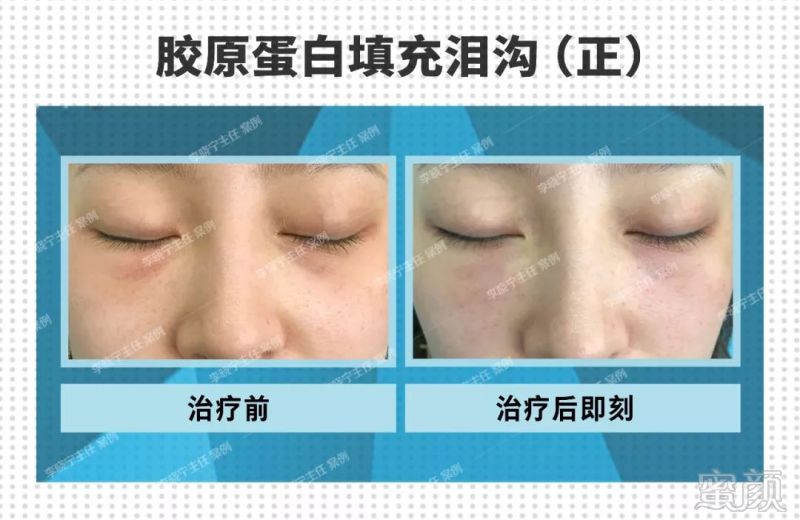 https://img.miyanlife.com/mnt/timg/190128/11560AT3-0.jpg